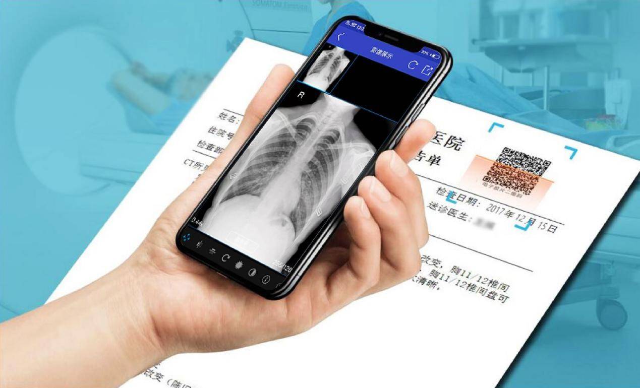 云膠片是什么？